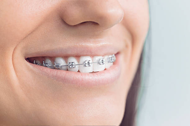 Best Wisdom Tooth Removal  in Mammoth, AZ